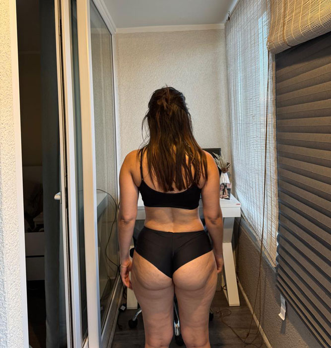 Before Transformation 4